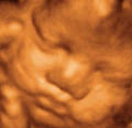 Precious Previews 3d/4d Ultrasound logo