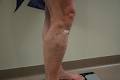 The Varicose Vein Clinic image 3