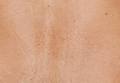 Psoriasis & Skin Clinic - North Sydney image 4