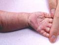 Psoriasis & Skin Clinic - North Sydney image 5