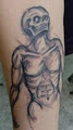 Tattoo Removal Sydney image 1