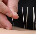 Bentleigh Lohas Chinese Medicine, Acupuncture Clinic logo