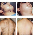 Evolution Laser Hair Removal Clinic logo