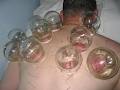 New China Acupuncture Centre image 2