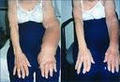 Newcastle Lymphoedema Clinic image 3